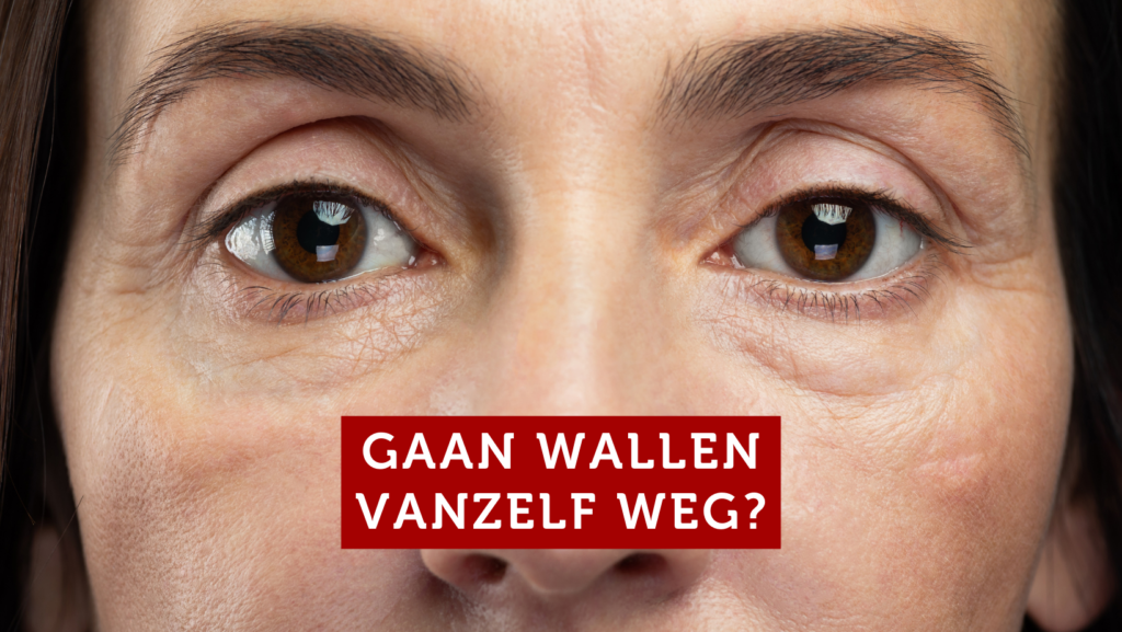 Kunnen wallen vanzelf verdwijnen?