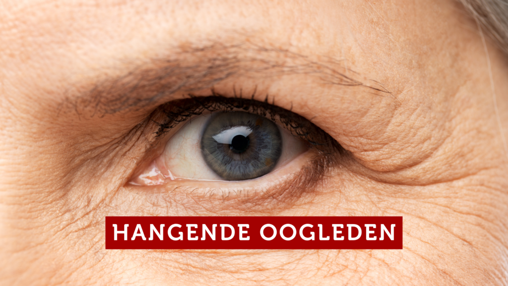 Hangende Oogleden – wat kun je er aan doen?